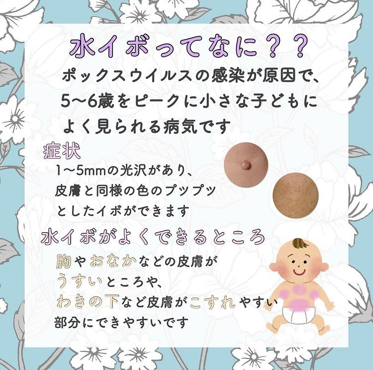 水イボってなに？？